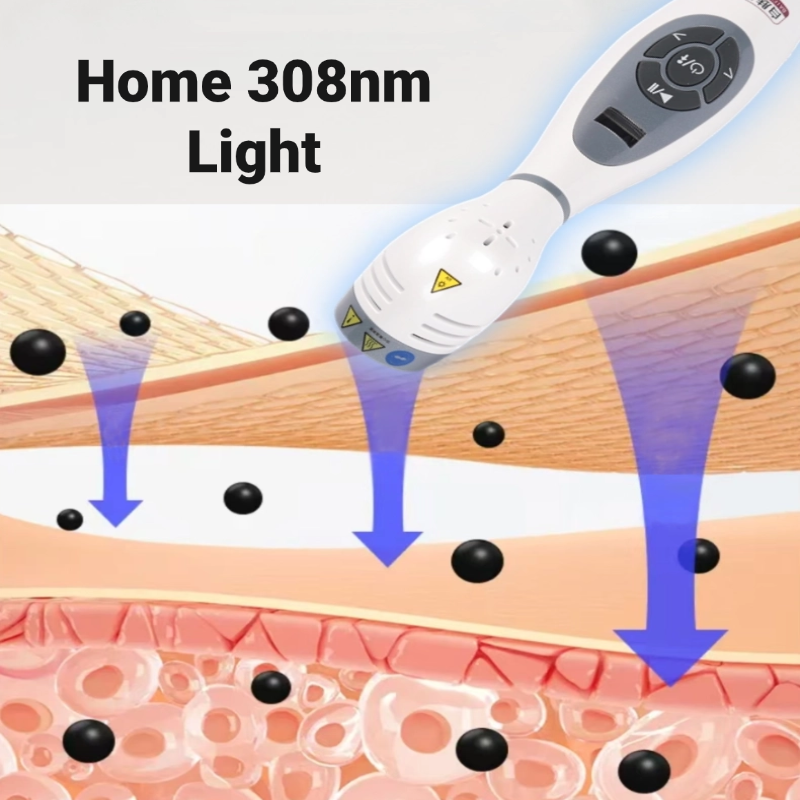 Home Phototherapy Device