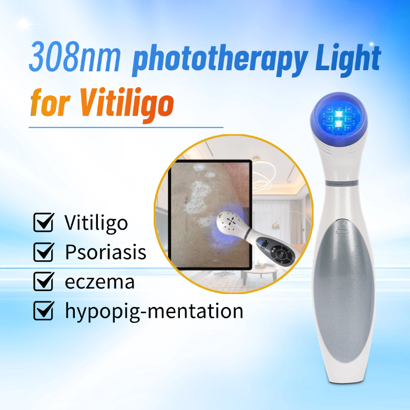 Home UVB Phototherapy Kit